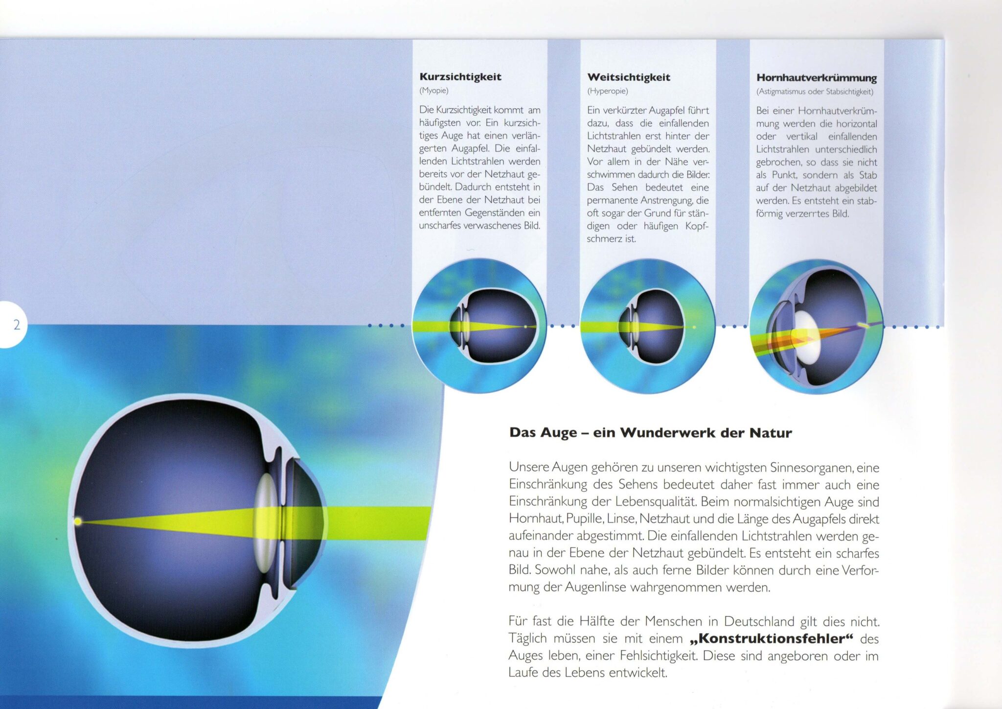 Hornhautverkrmmung Lasern Ab Wann